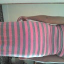 back view, 6 days pre op