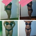 The difference are 1 week apart...I see the light...still swelling...