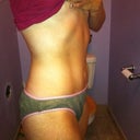 1 year post op!