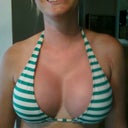 About a month and 2 weeks post-op