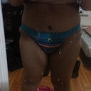 I have dents on my hips which is why I need fat transfer there.