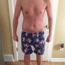 1 week post op