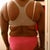 before surgery (back)