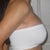 6 weeks post op - right side view