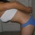6 weeks post op - bent over side view