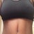 PO Day 15 - Full frontal view
