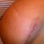 scarring on left boob, not bad