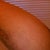 right boob side scarring
