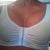 Still having 2 wear this compression bra 24/7. Not loving that!!