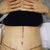 This is on day 6, post surgery.  All post pics thus far are taken laying down.