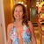 Great TT and lipo results after 10 months. 55 and lovin it!!