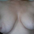 sagging and asymmetry, difference in nipple size