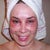 2nd day:  Shower, let water run over face while gently exfoliating dead skin with fingertips.  Ouch! Spot lasering on face too.