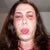 Day 4.  Painfully raw.  Today I took the narcotic pain pill.