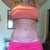 Almost 2 months PO Scar