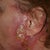 LIFE THREATENING LSL - 
