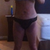 after, 48 hrs. post op
