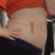 2 weeks post