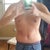 2 weeks post op
