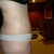 6 weeks post op - side view