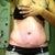 2wks PO