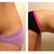 Before versus 9wks 2 days post op.