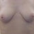 3 months before op