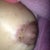 The weird red skin at top of incision