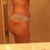 Side Day 14 (still swollen!!)
