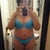 Day 11 still very swollen in my belly. But its starting to flatten out. My belly button is off due to swelling. That bothers me :(