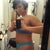 Day 11 side view. Tummy has gone down a bit. Doesn't protrude as much.