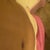 The Bulge above my scar...Seroma?? or Swelling???, 2 wks PO