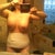 2 week post op mommy makeover