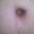 Belly button looks pretty good.