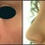 Left: Profile before surgery, Right: Profile after surgery