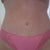 tummy 6 months