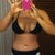 10 days PO, very swollen belly button but so far I'm happy with my results. Can't wait for that last drain out.