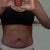 before front view love handles