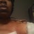 The day after surgery Bandages removed, breast numb