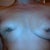Almost 3 full months after explant, my PS shot my breasts with something to help speed up the scar tissue that's pulling my nipples into my muscle.  I just want to get hit by a truck and die.  I hate myself.