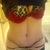 3 weeks post opp....and still shirking :) as soon as I take the tape off i'll post another pic.