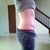16 weeks post op
