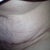 What a tummy tuck scar really looks like when sitting down up close. How has no one posted a picture like this? As the first consultation dr said "it loosens up"  It does no matter how tight.know this