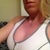 1 day post op side view with sport bra  :)