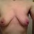 front view pre-op