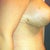 Swollen 19 days in the morning