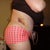 Day 5 Post Op....VERY swollen.  bruising from lipo