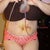 Day 5 Post Op....VERY swollen.  bruising from lipo around belly button