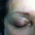 My eyebrows BEFORE the procedure. As you can see I had some old PMU. It just looked awful...
