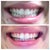 Before/Tray 8
